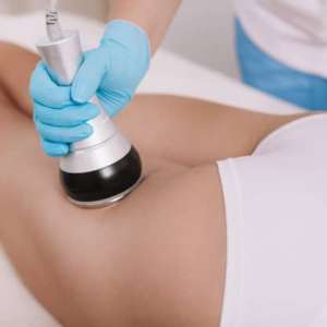 Levantamiento y Modelación de Glúteos